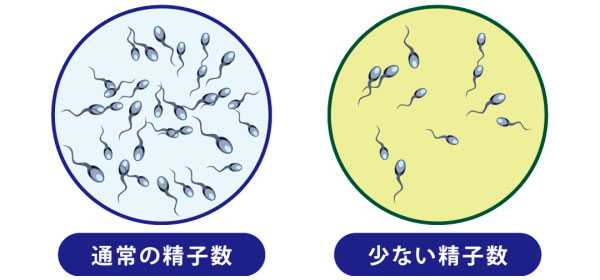 無精子症と診断されたら最初にすることは 健康新聞デジタルニュース